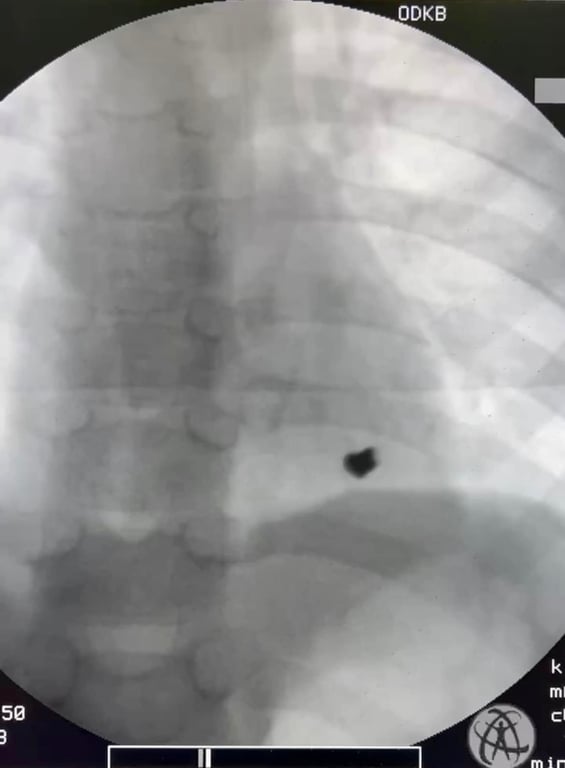 Операция в Одессе