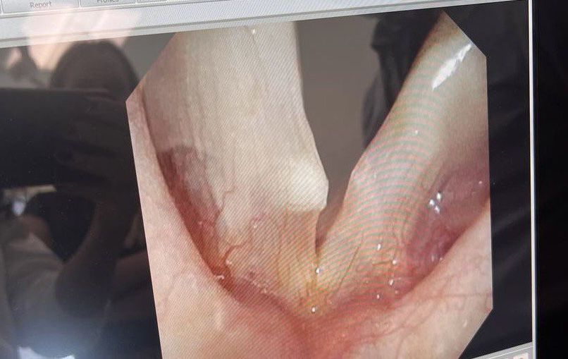 Новообразования у Каменских