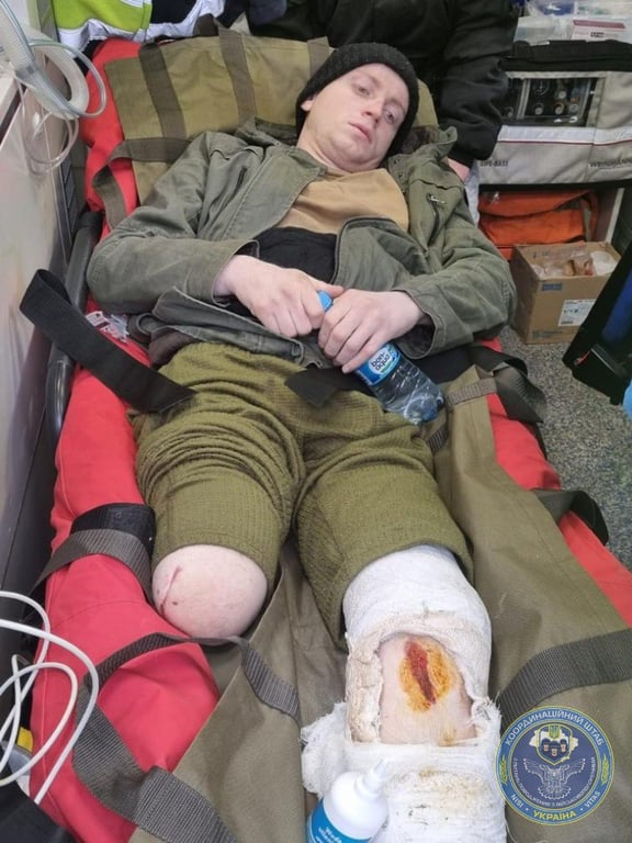 Передача россии раненых пленных