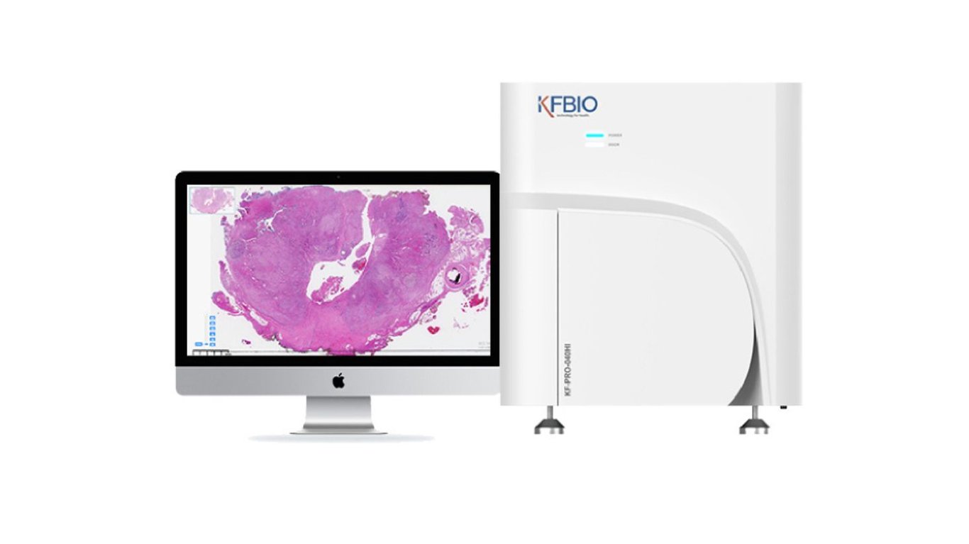 диагностика рака