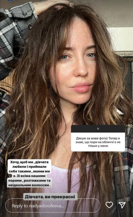 Натуральна краса: Дорофєєва вразила своїм фото без макіяжу - фото 1