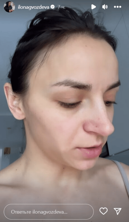 Stories Ілони Гвоздьової в Instagram