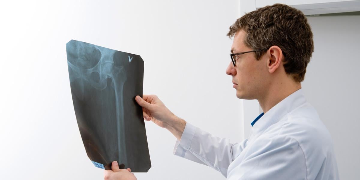 Що таке остеоартроз