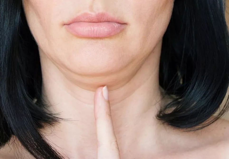 подвійне підборіддя