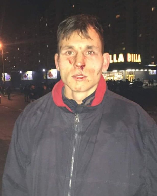 Новикова избили полицейские