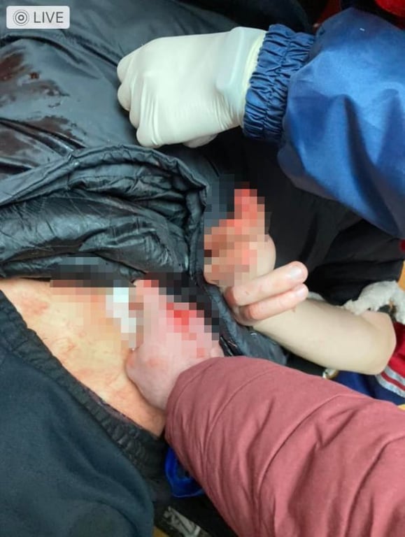 На чоловіка напали з ножем