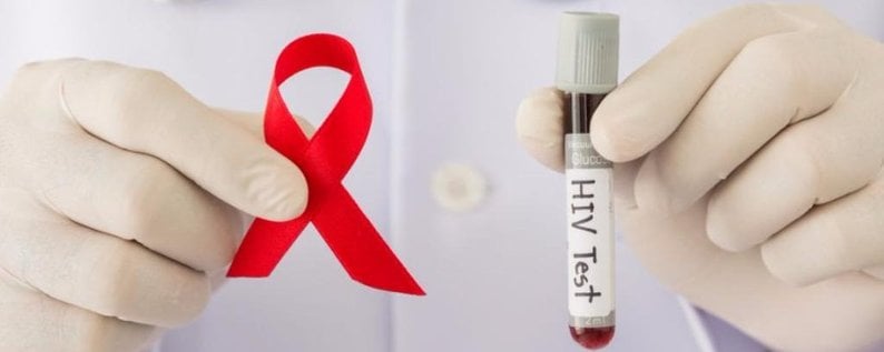 ВІЛ - лікування