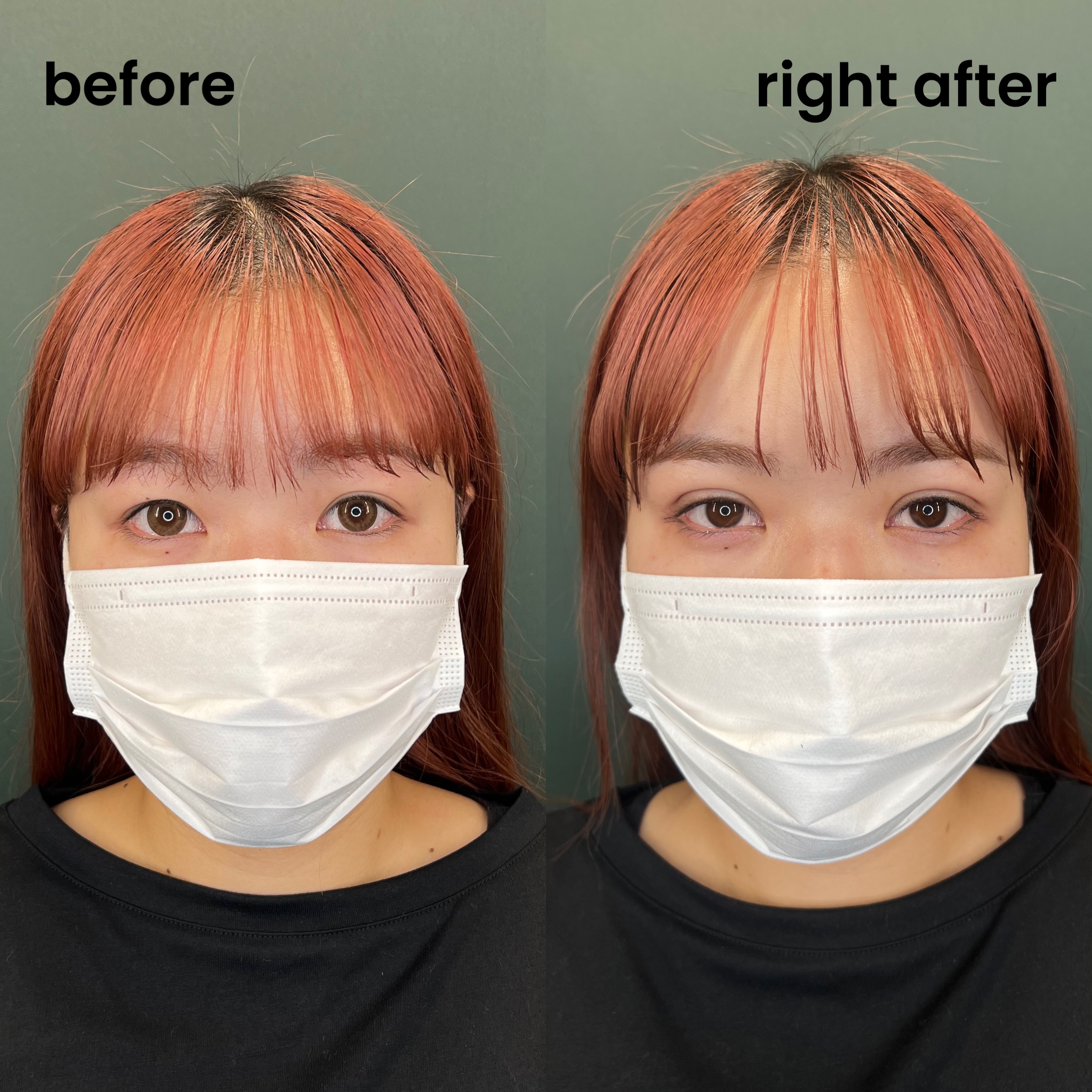 Comparison; Asia vs Europe