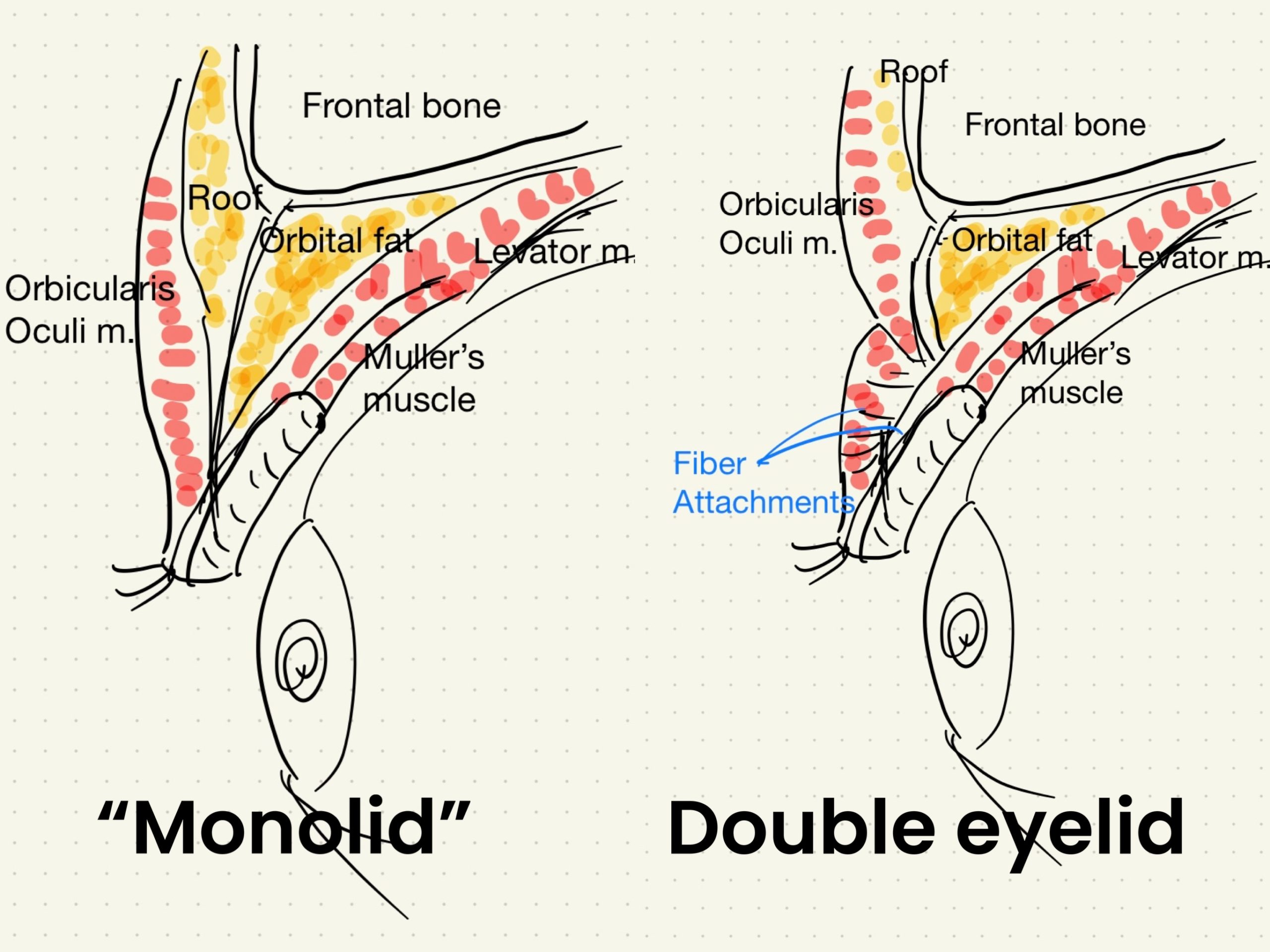 What I Pay Attention To During the Double Eyelid Noninvasive Surgery.