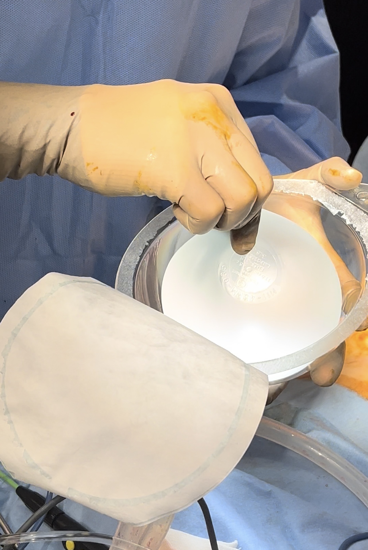 Breast Augmentation -Silicone Implant-