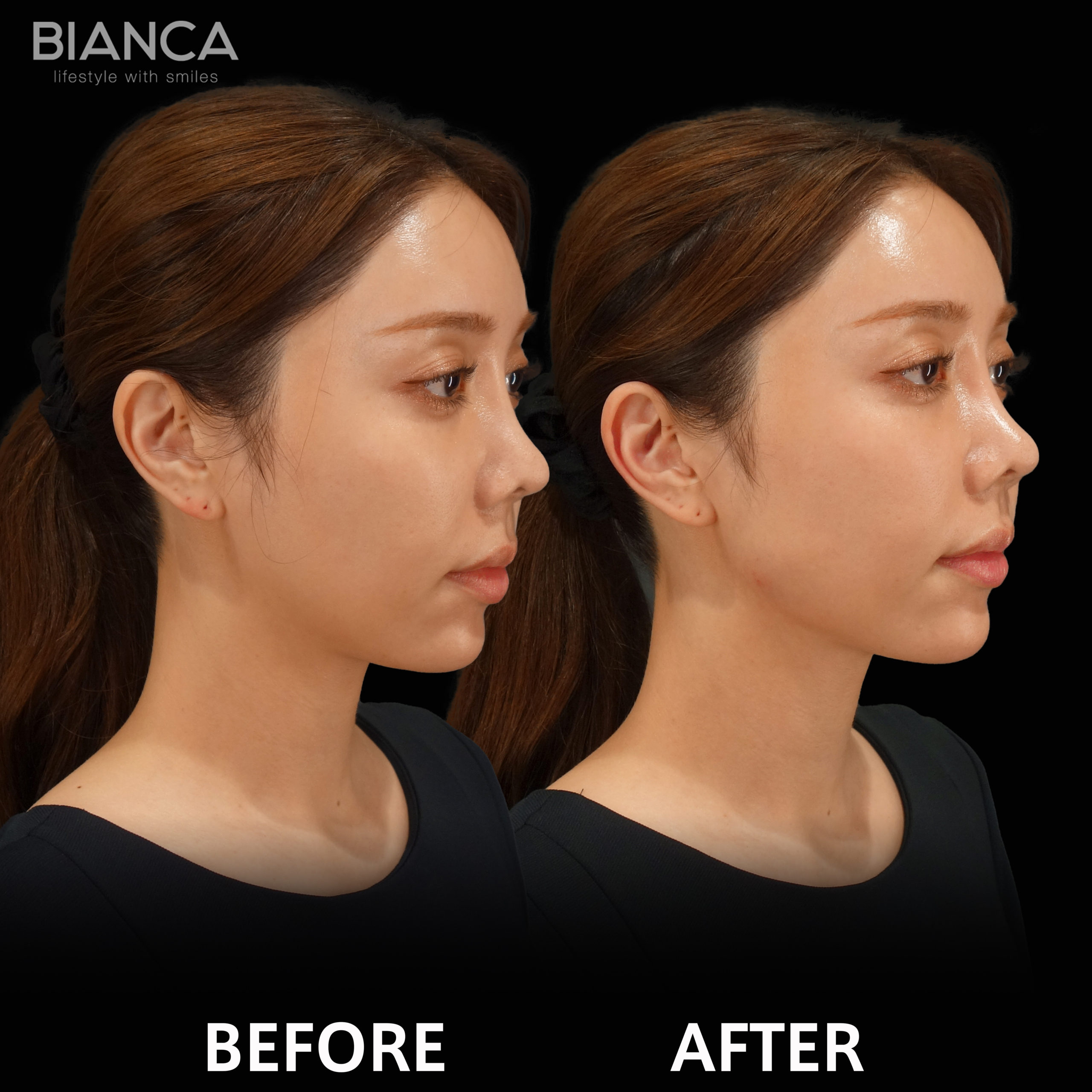 The Power of a Defined Jawline: Making Your Face Look Smaller