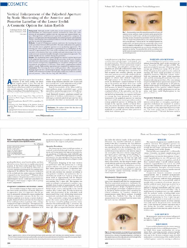 Lower the lower Eyelid