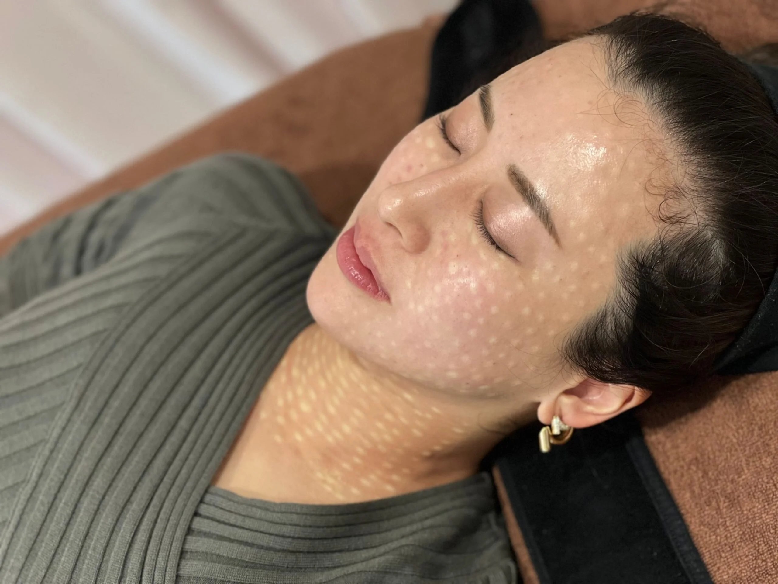 Hydro Boost Treatment: The Ultimate Skin Solution