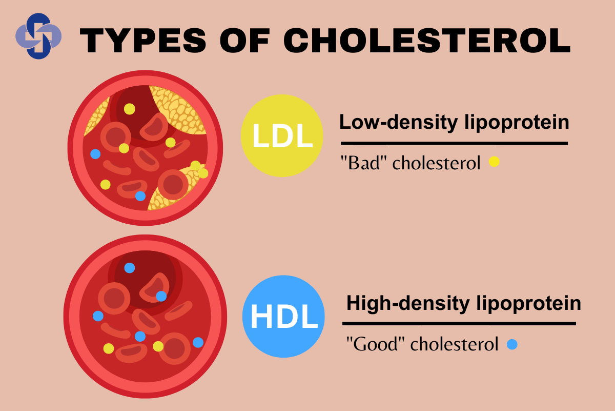 Is Bad Cholesterol Really Bad? Explained by a Cosmetic Internal Medicine Doctor