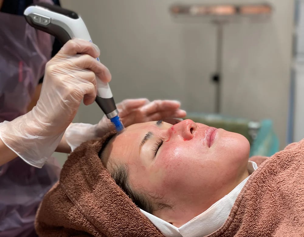 The most requested treatments in Japan