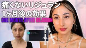 Painless Rejuran at Bianca clinic!