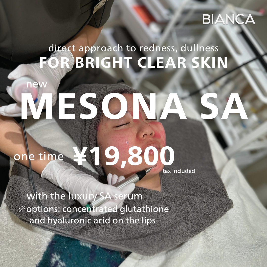 Explaining the new Mesona SA