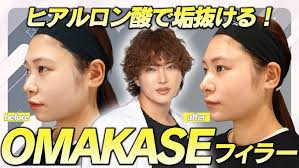 OMAKASE FILLER: The art of enhancing natural beauty. Only at BIANCA CLINIC