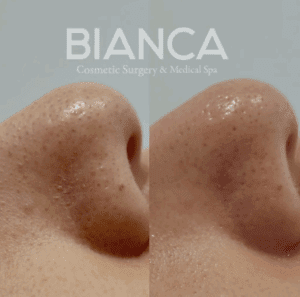 Facial Clinic Near Me with English-Speaking Medical Spa Care in Tokyo