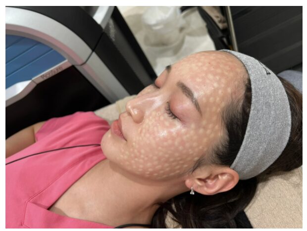 BIANCA’s Recommendation: What is ‘Hydro Boost’? Explained and compared to other skin treatments.