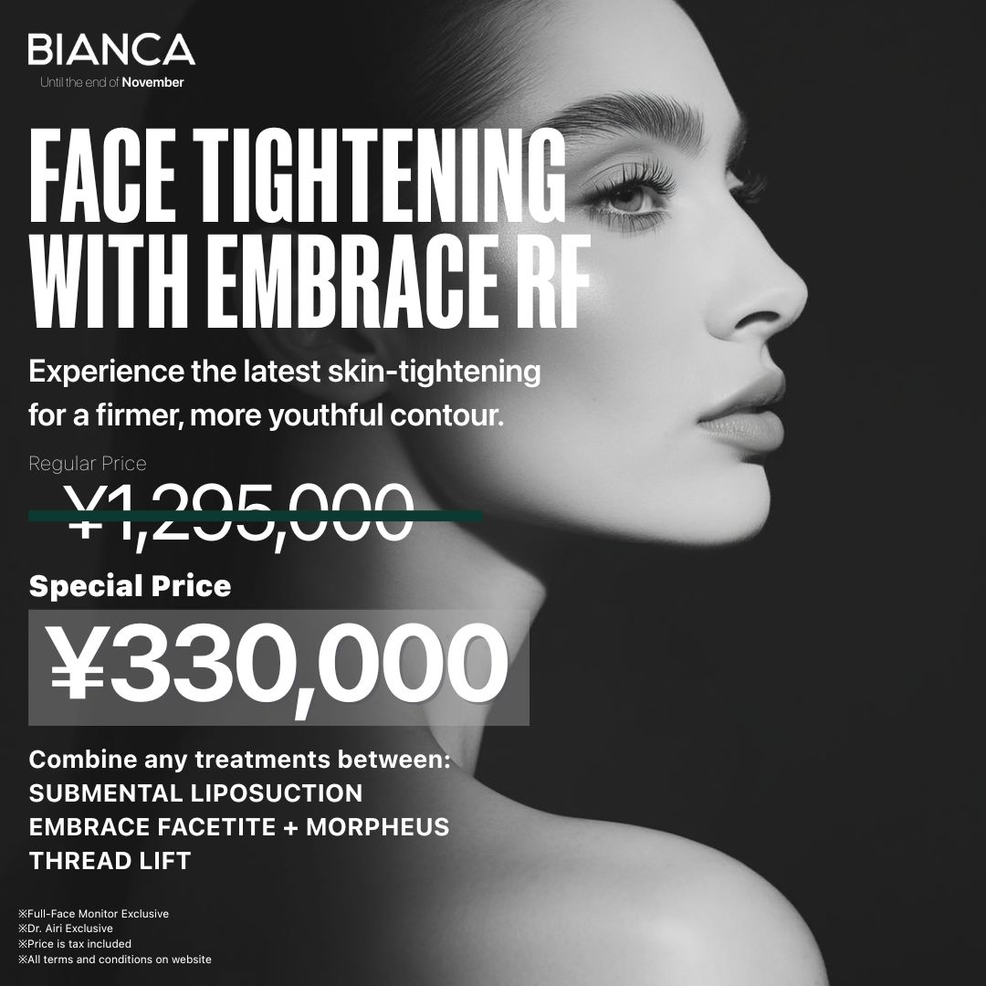 Campaign post thumbnail