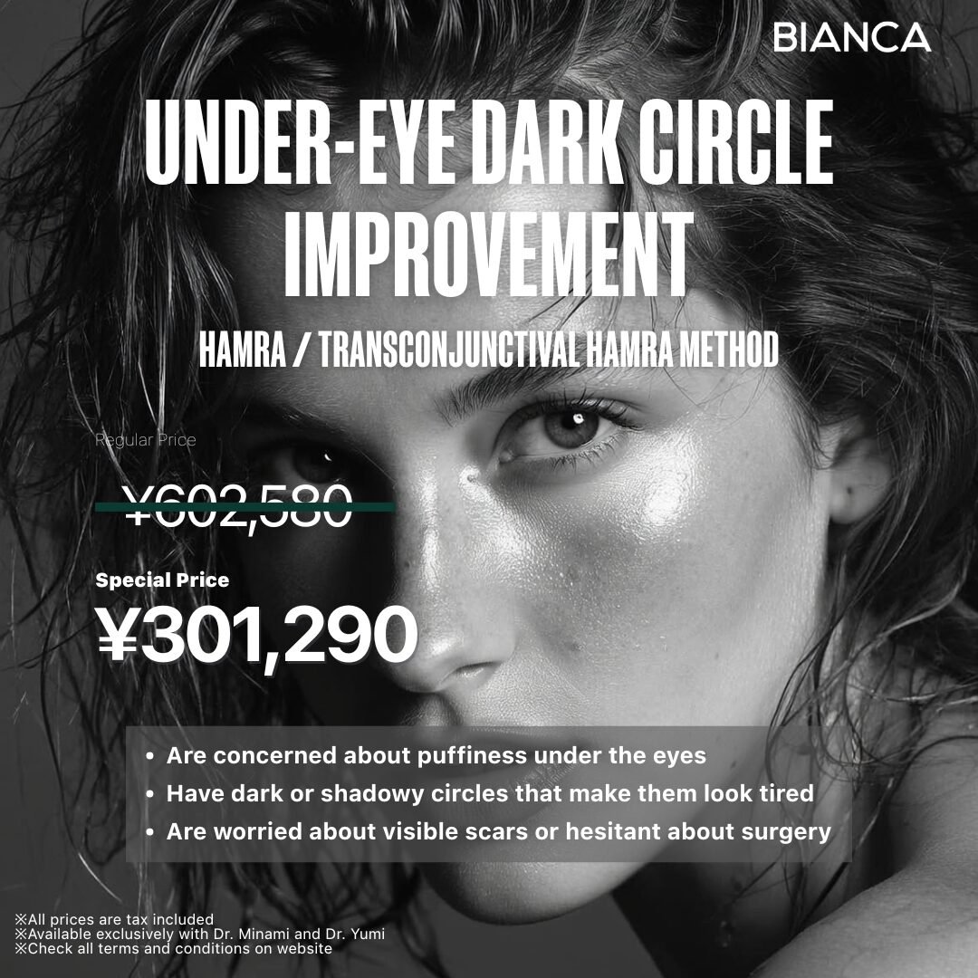 Campaign post thumbnail