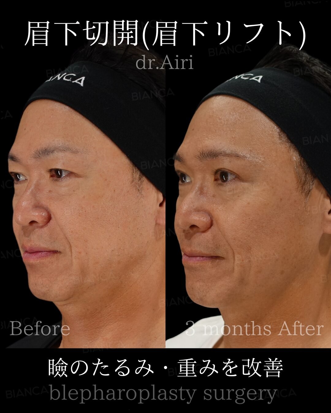 Your Trusted Plastic Surgery Clinic in Tokyo: Expert Care with an International Touch