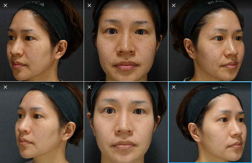 Beyond the Laser: Cosmetic Surgery and Pigmentation Treatment Excellence in Tokyo