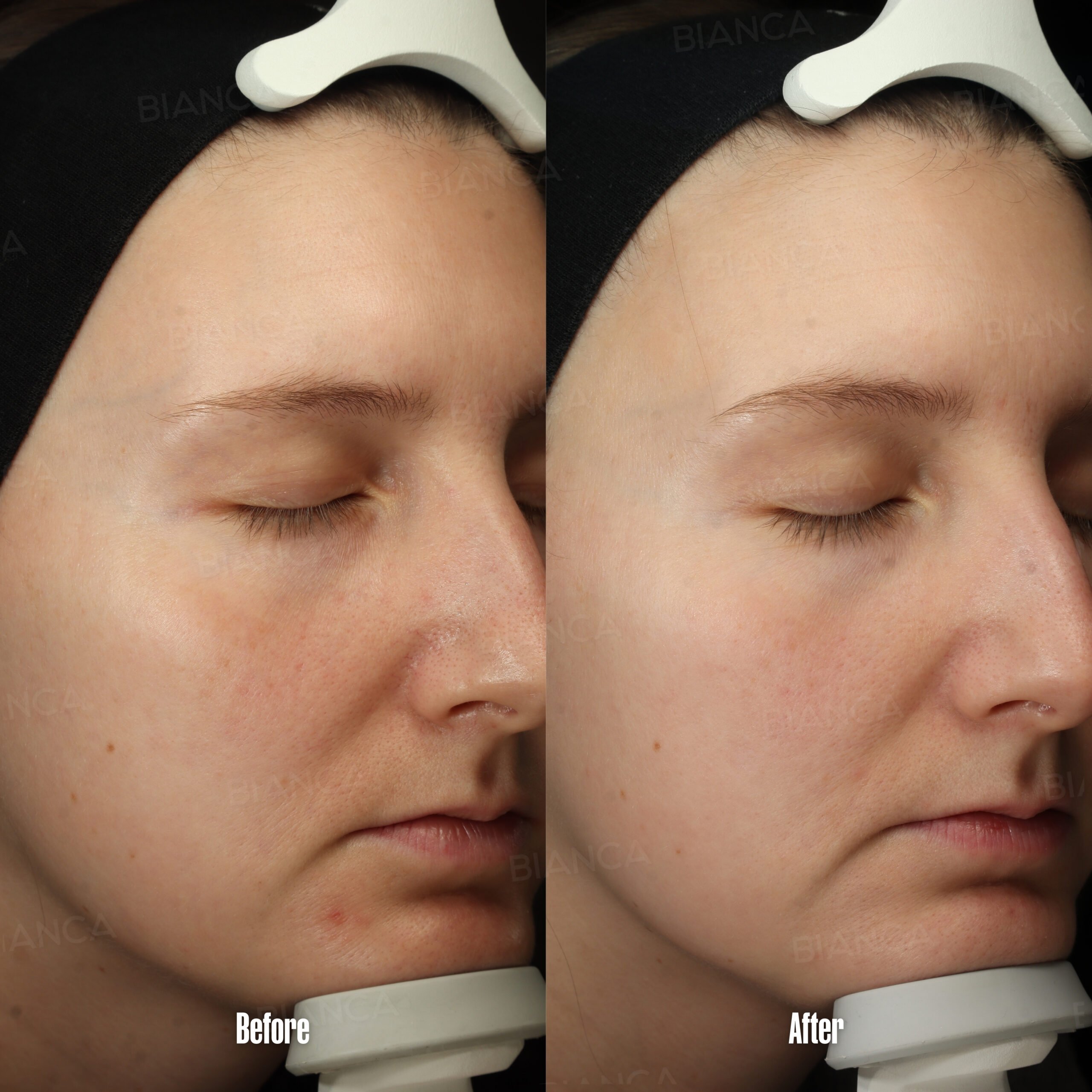 Your Guide to Finding an Aesthetic Clinic Near Me in Tokyo: Expert Care with an International Heart