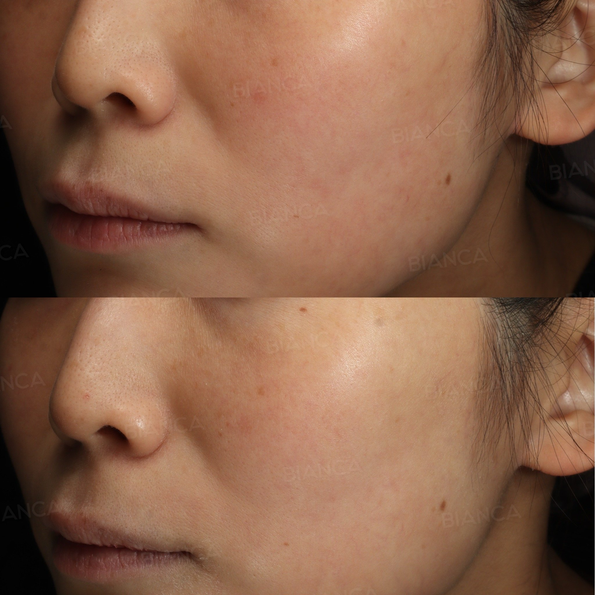 Skin Whitening Treatment in Tokyo: Doctor-Guided Options at a Modern Medical Spa