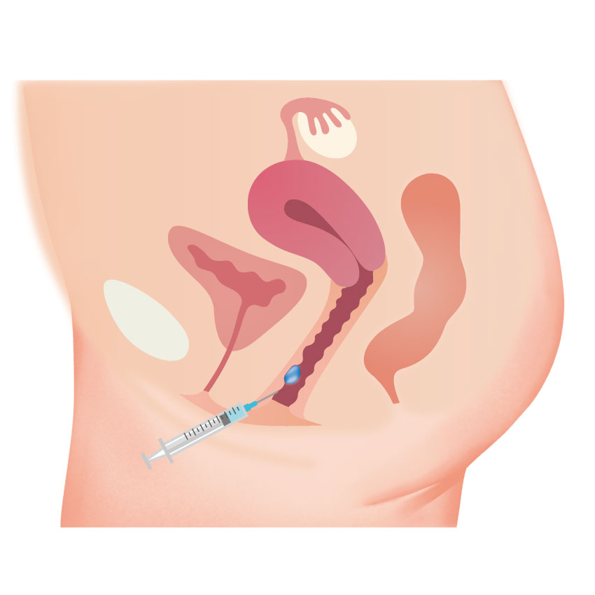 Intimate Area Rejuvenation: Safe, Evidence-Aware Options for Female  Wellness