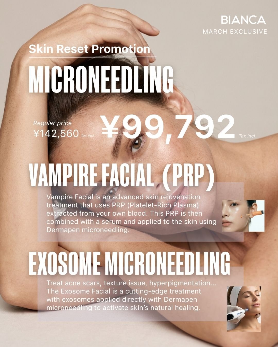 【March Exclusive】Microneedling : choose between Vampire Facial or Exosome