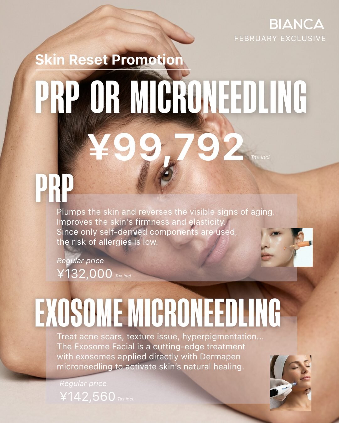 February Boost Promotions