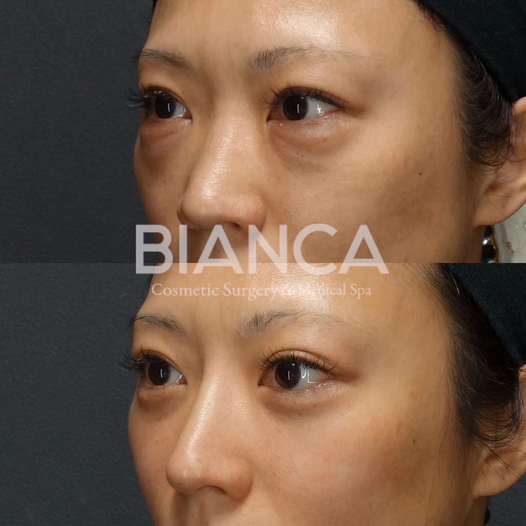 Plastic Surgery Before & After: Clear Results and Caring Guidance in Tokyo, in japan