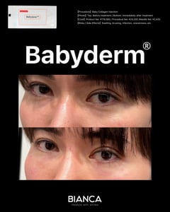 BABYDERM|Trust BIANCA in Tokyo, Japan tailored to your love handles. love handles BIANCA in Tokyo, Japan