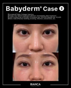 BABYDERM|Trust BIANCA in Tokyo, Japan tailored to your love handles. love handles BIANCA in Tokyo, Japan