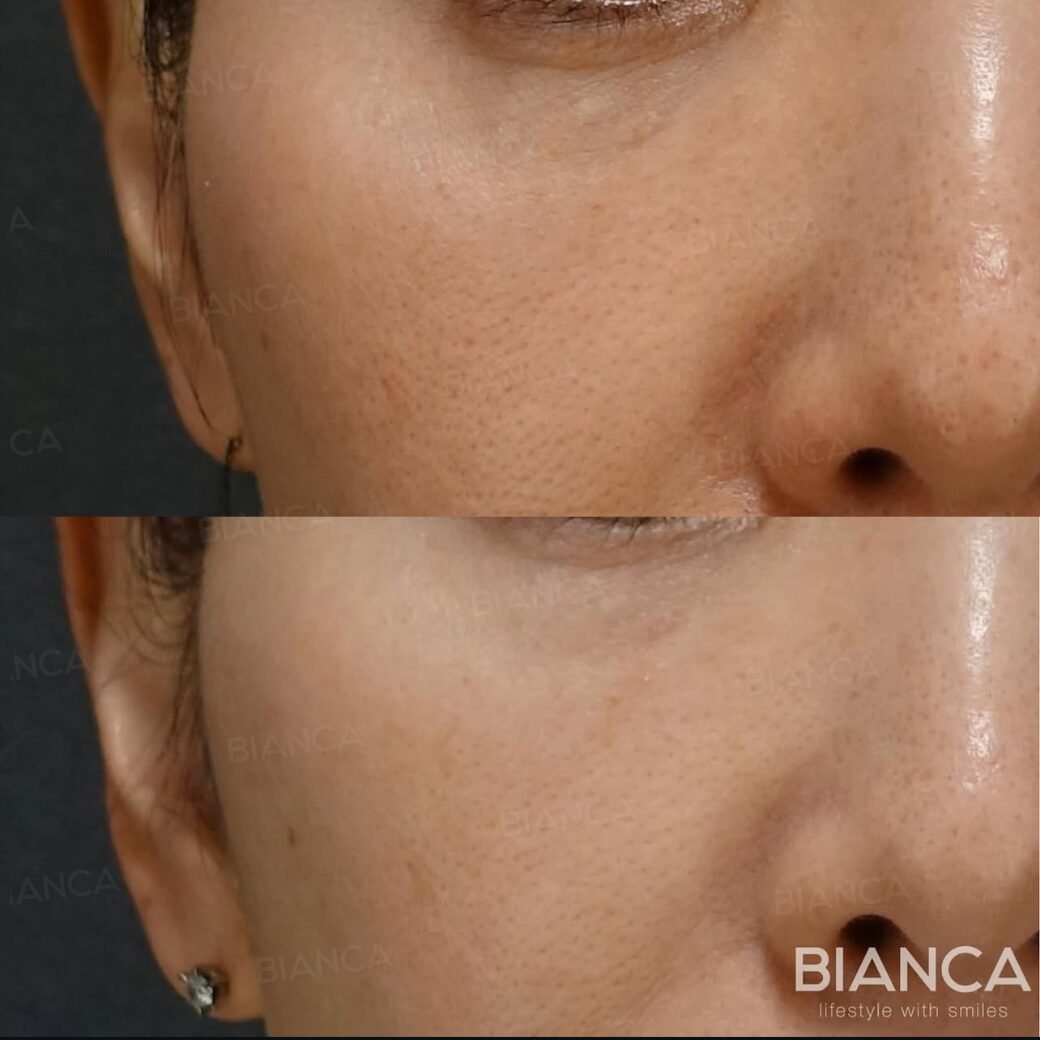 PDRN Japan: Your Clear, Friendly Guide to Fresh Skin in Tokyo