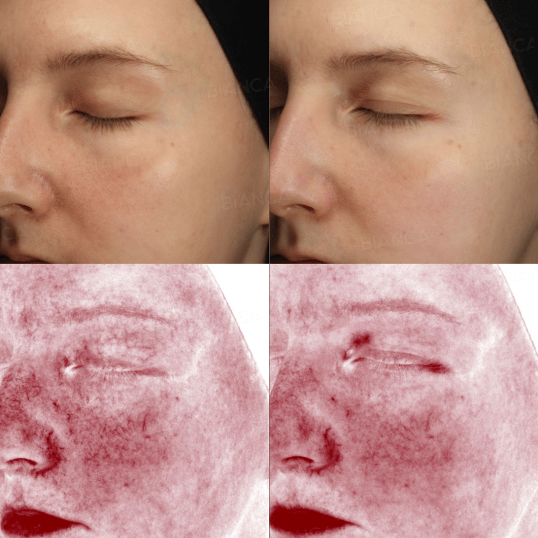 Medical Spa Treatments With Proven Results in Tokyo