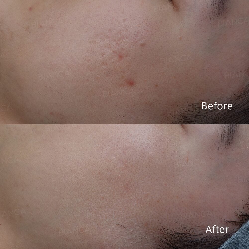 PRP in Tokyo: The Next Great Blend of Science and Artistry