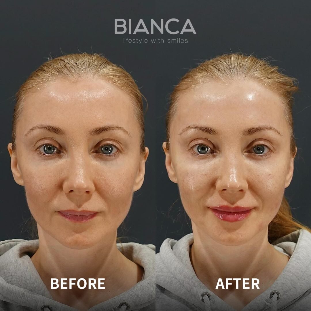 Glass Skin in Japan: The Next Frontier in Skin Radiance is Here to Stay in Tokyo