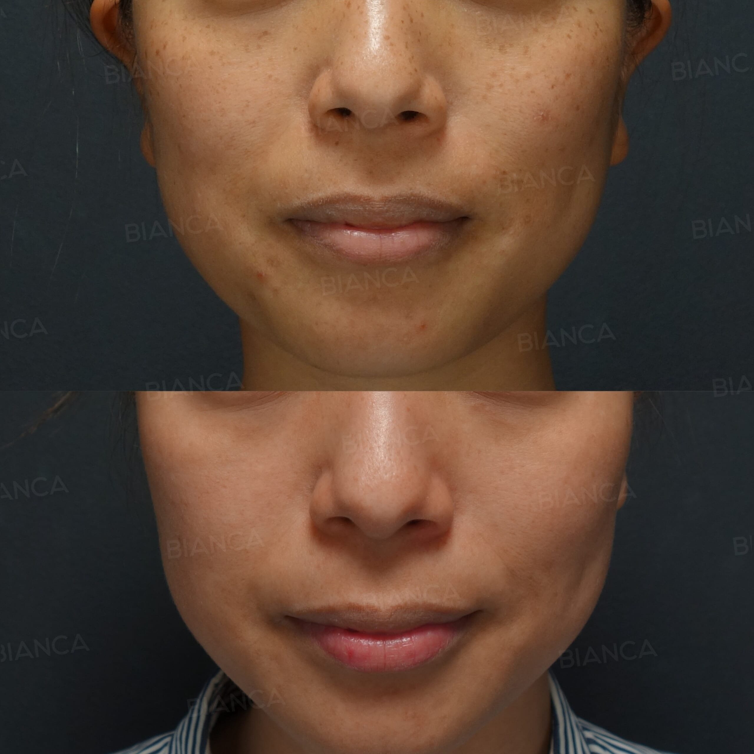 Strawberry Skin Treatment: The Fantastic News Everyone’s Been Waiting for in Tokyo