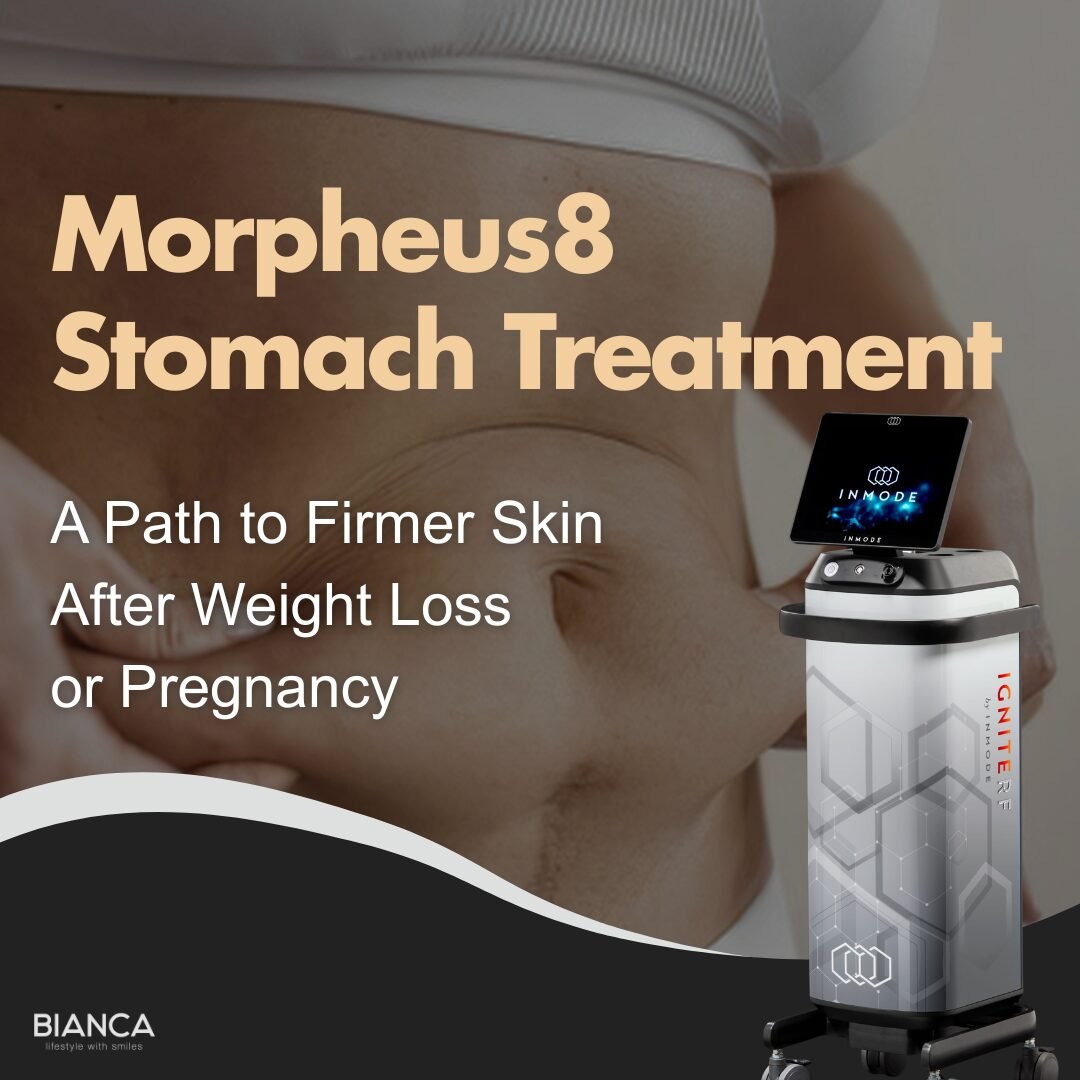 Morpheus8 Stomach for Abdomen Skin Tightening