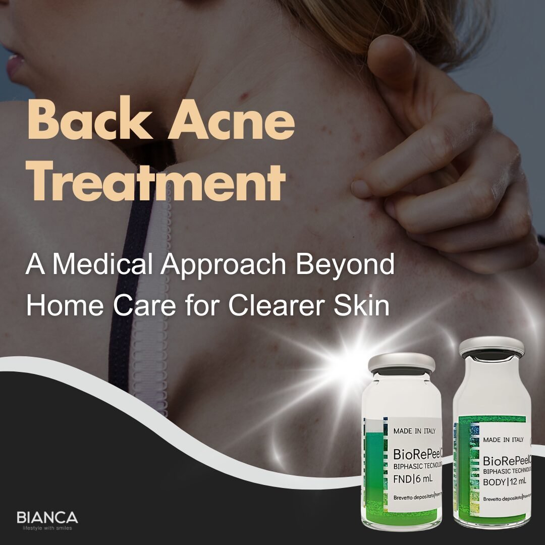 Back Acne Treatment | Professional Clinical Solutions and Daily Hygiene at BIANCA CLINIC Tokyo