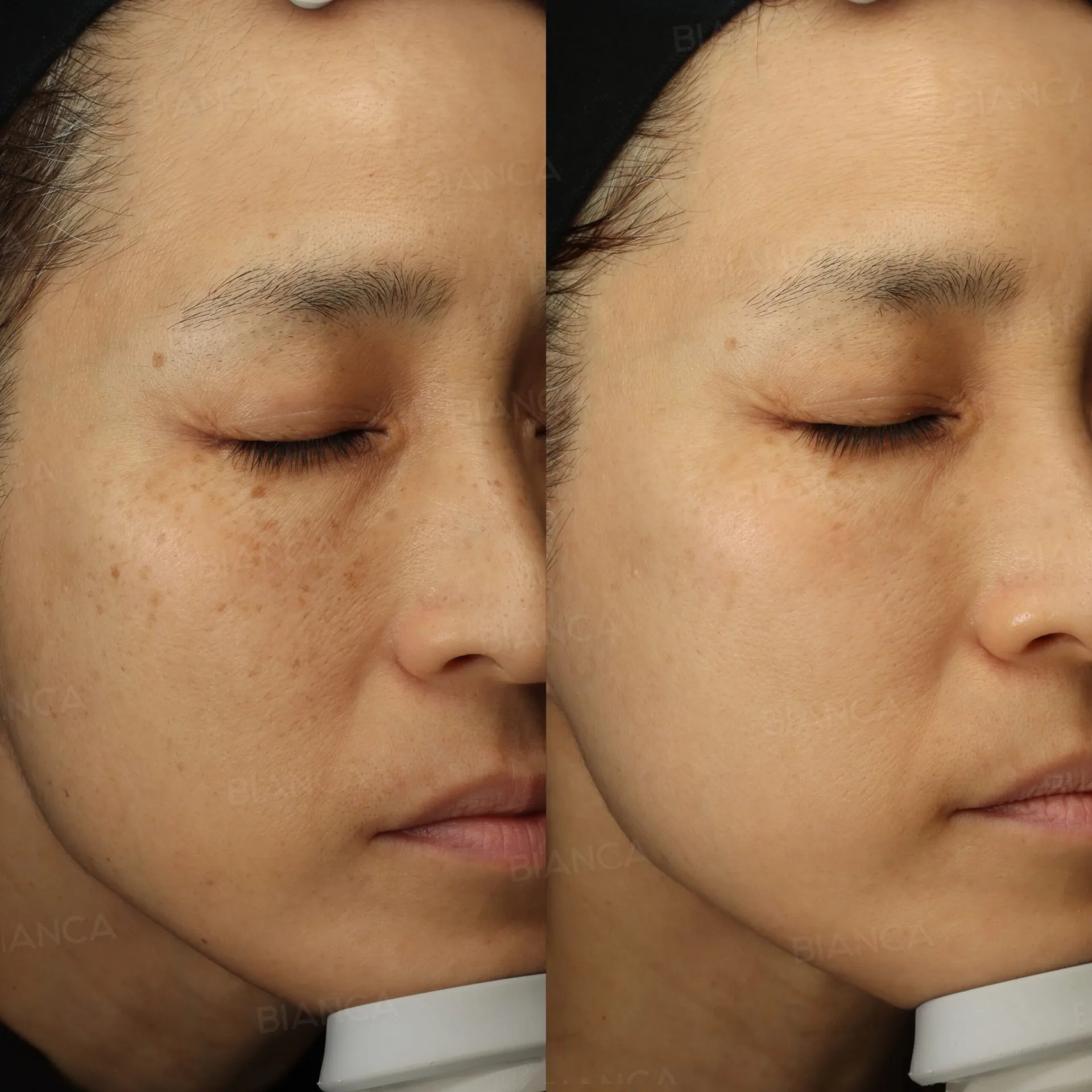 Best Luxury Aesthetic Clinic and Medical Spa in Tokyo