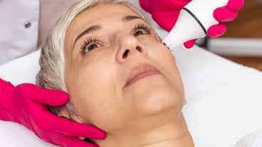 Beautiful older woman with radio waves lifting facial treatment.