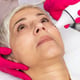 Beautiful older woman with radio waves lifting facial treatment.