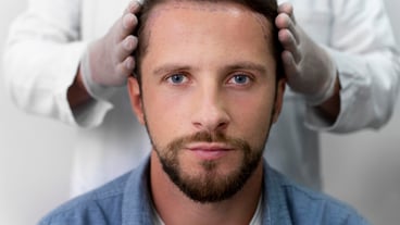 Adult male doing a follicular unit extraction