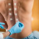Doctor Doing Skin Allergy Test