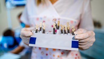 Palette con sfumature di denti. Campioni dentali di denti colorati. Primo piano.