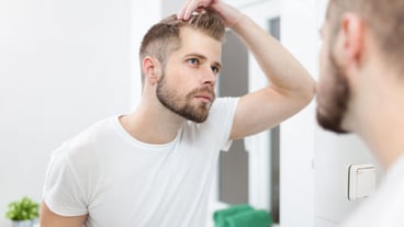 Handsome young man worried about hairloss